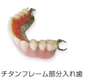 部分入れ歯タイプの金属チタン義歯